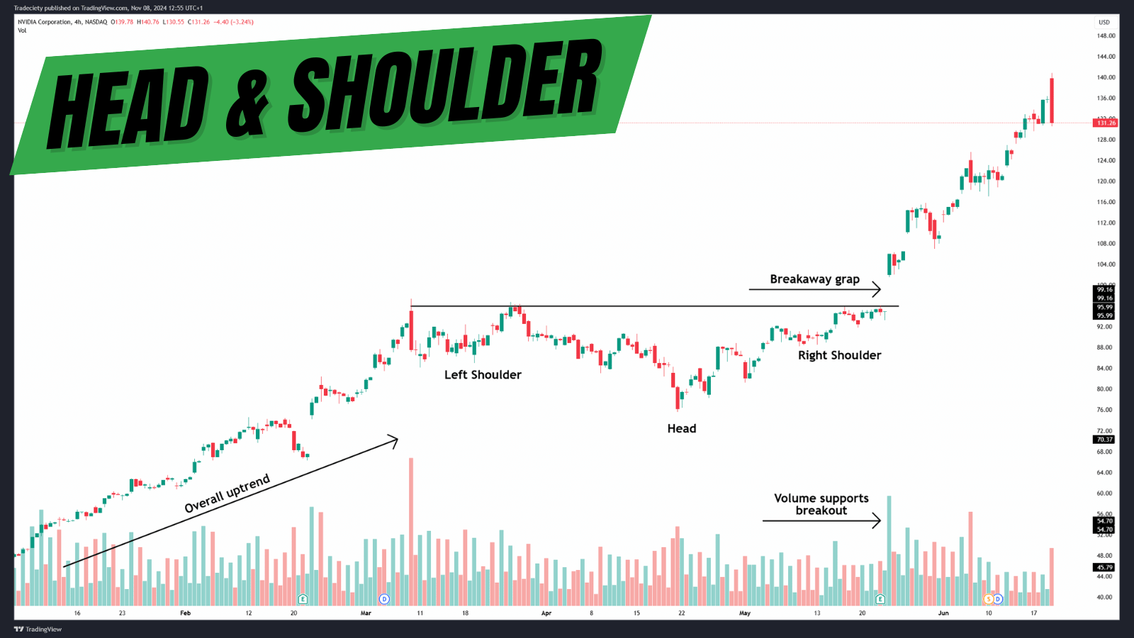 Head and Shoulders